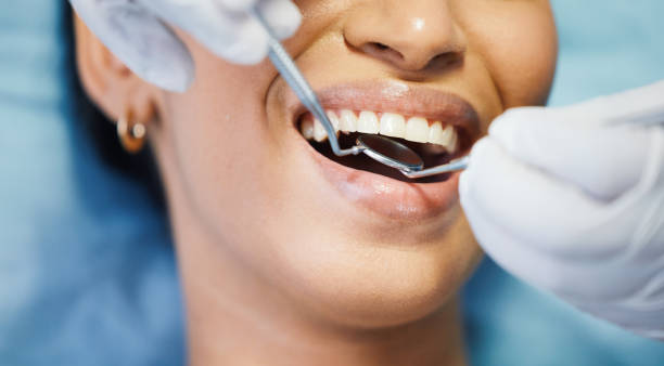 Best Emergency Denture Repair in Dranesville, VA