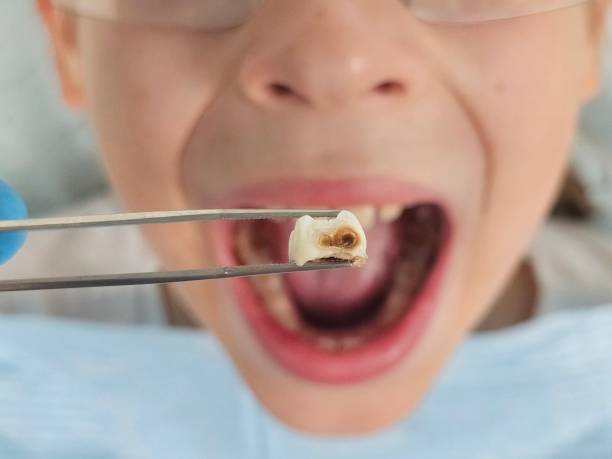 Best Cosmetic Emergency Dentistry in Dranesville, VA